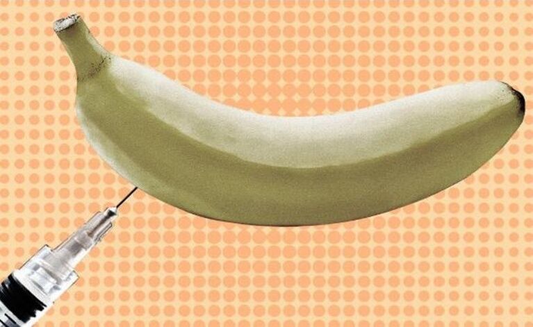 injekcijsko povećanje penisa na primjeru banane